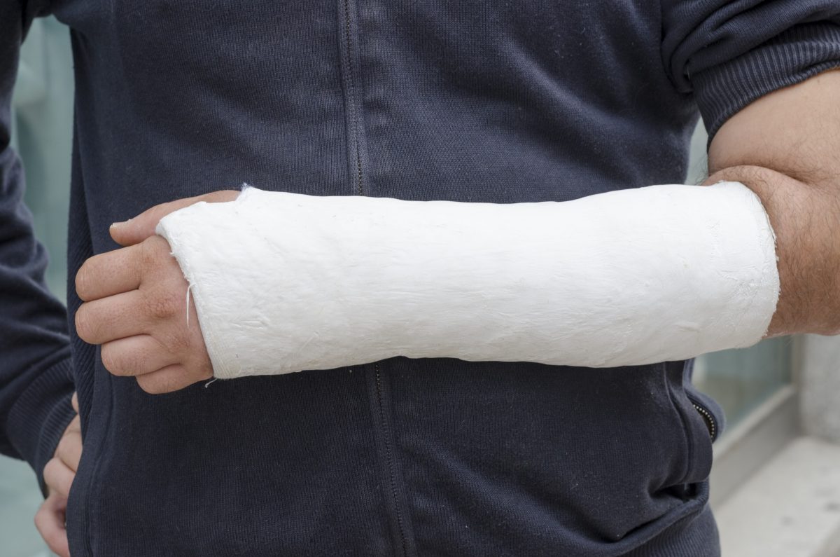 Фото гипс на руке: Gipsverband Изображения, стоковые фотографии и картинки Gipsverband